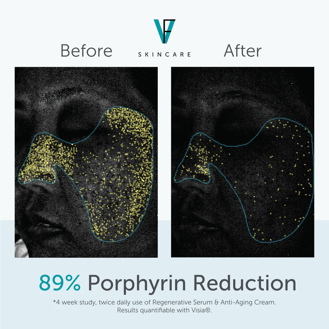 Factor Five Regenerative Serum