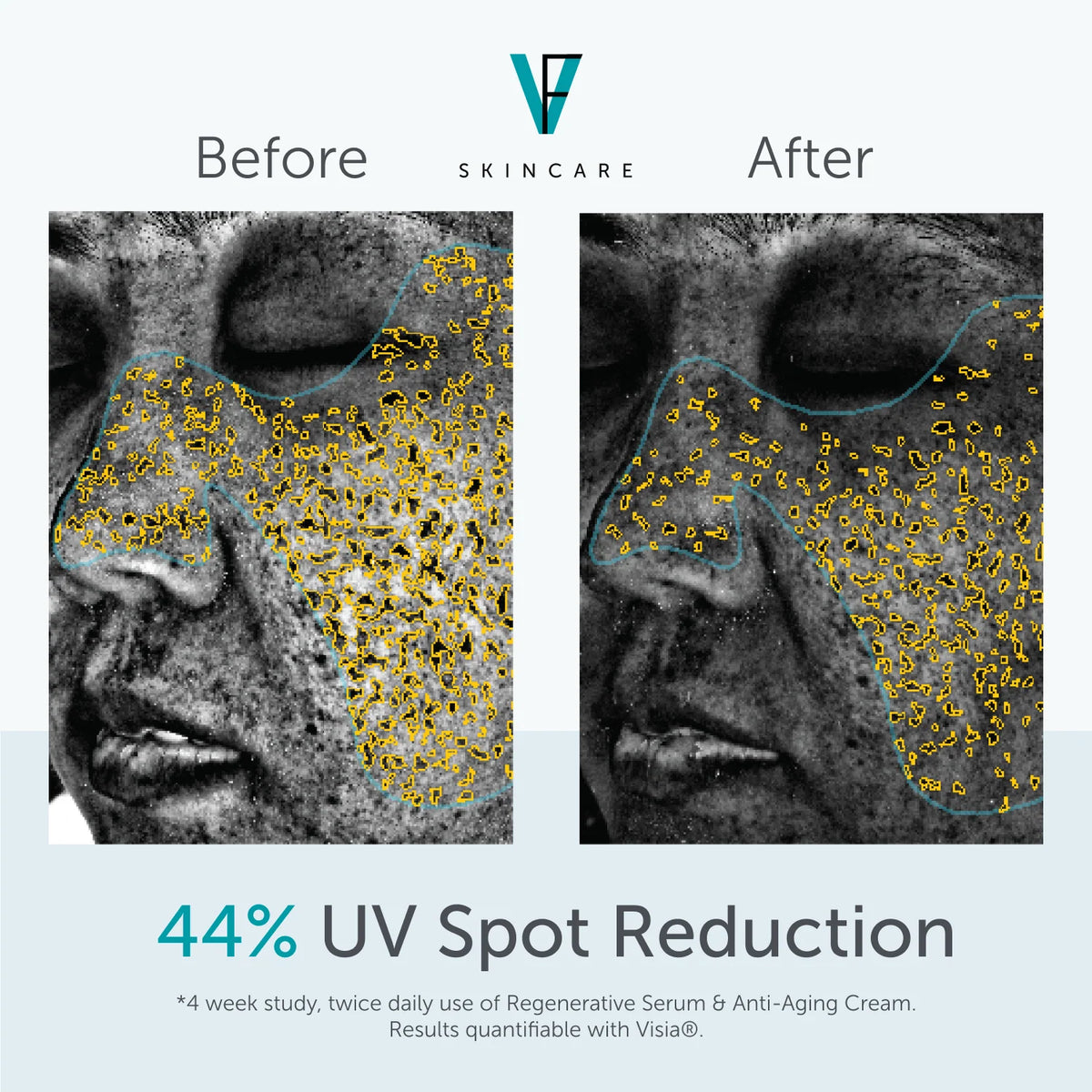 Factor Five Anti-Aging Cream