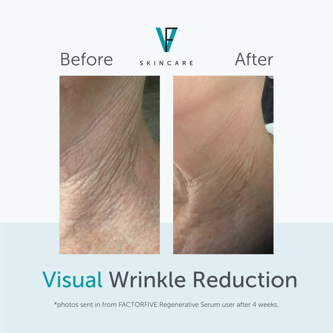 Factor Five Regenerative Serum